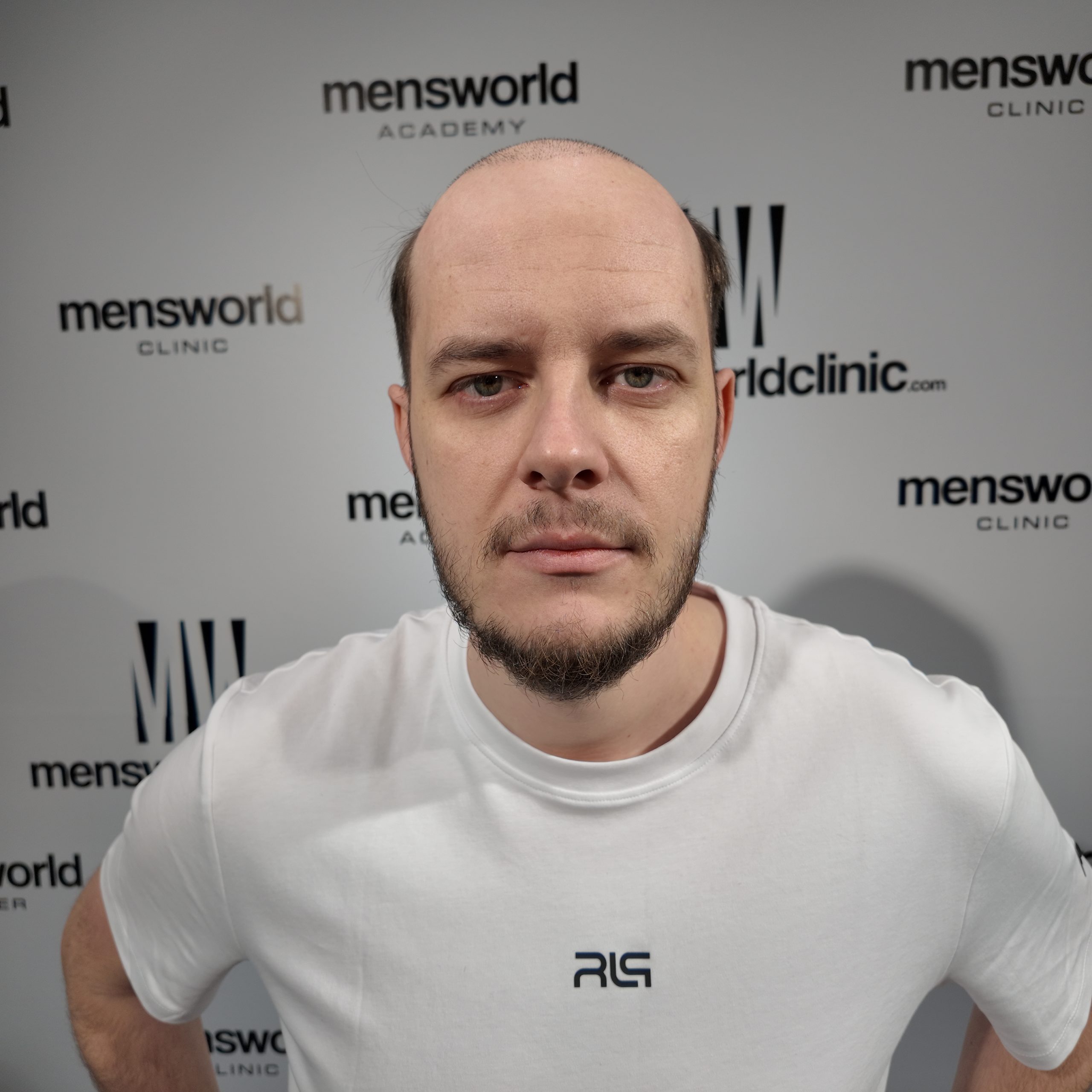 Zdjęcie twarzy na wprost